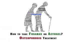 Osteoporosis treatment mount elizabeth singapore 4 