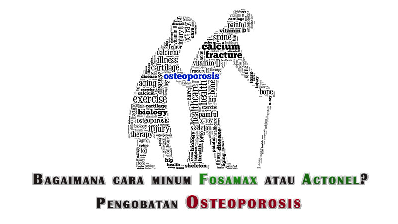 Pengobatan Osteoporosis | Bagaimana cara minum Fosamax atau Actonel 