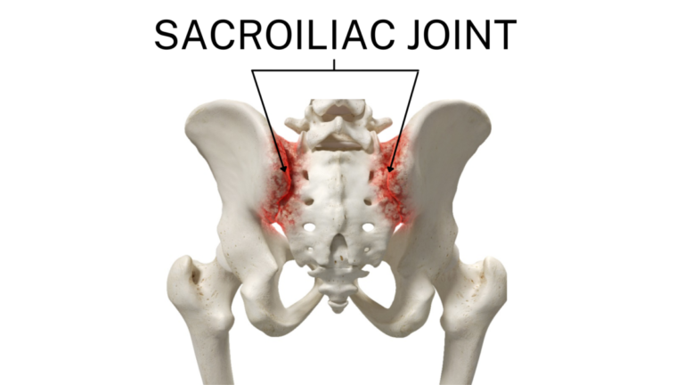 Sacroiliac (SI) Joint Dysfunction - Orthopaedic Spine Surgery Singapore