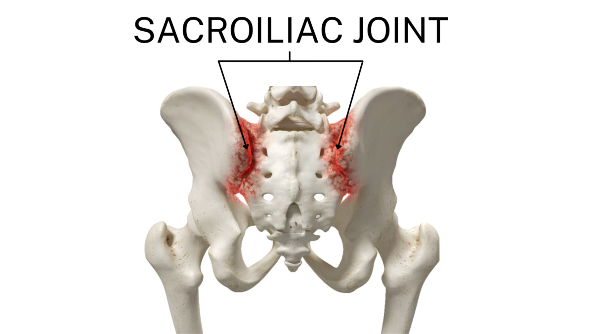 Sacroiliac (SI) Joint Dysfunction - Orthopaedic Singapore