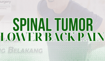 Spinal Tumor – One of the Causes of Lower Back Pain