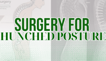 Surgery for Hunched Posture Can Increase Height