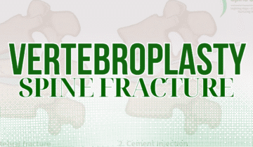 Vertebroplasty | Injection of Cement in Osteoporotic Spine Fracture