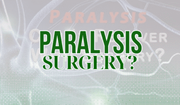 Paralysis | Can It Recover with Surgery?