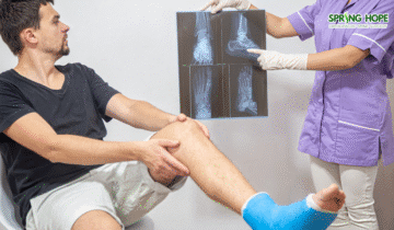 Bone Fractures: Causes, Symptoms, and Treatment Options 