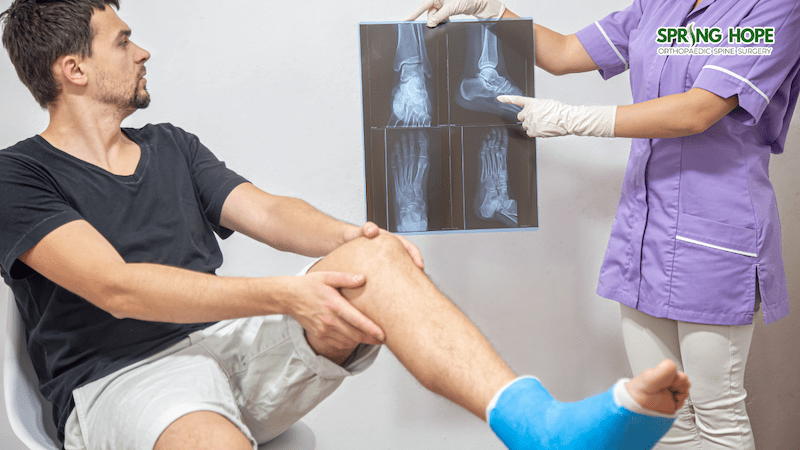 Bone Fractures