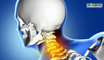 Cervical Spondylotic Myelopathy