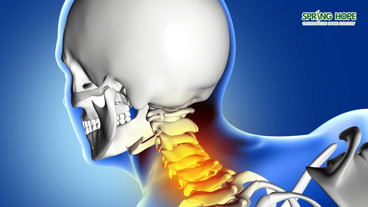Cervical Spondylotic Myelopathy