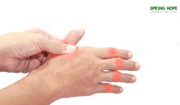 De Quervain’s Tenosynovitis: Symptoms, Causes, and Treatment