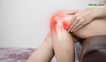 Osteoarthritis: A Comprehensive Guide to Causes, Symptoms, and Management