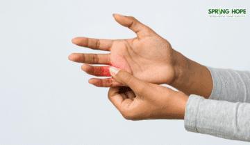 Trigger Finger: Causes, Symptoms, and Treatment