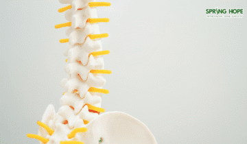 Ankylosing Spondylitis: Understanding the Reality of ‘Bamboo Spine’