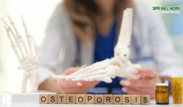 Mengenal Osteoporosis: Si Penyakit Diam yang Berisiko Fatal bagi Tulang