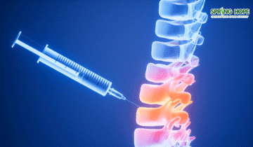 Exploring Spinal Injections: A Path to Managing Spinal Stenosis and Slipped Disc Pain