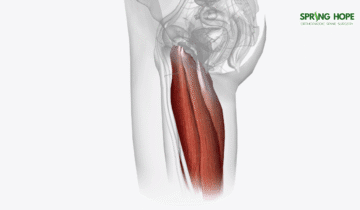 Tendinosis: Gejala, Penyebab, dan Pilihan Pengobatan