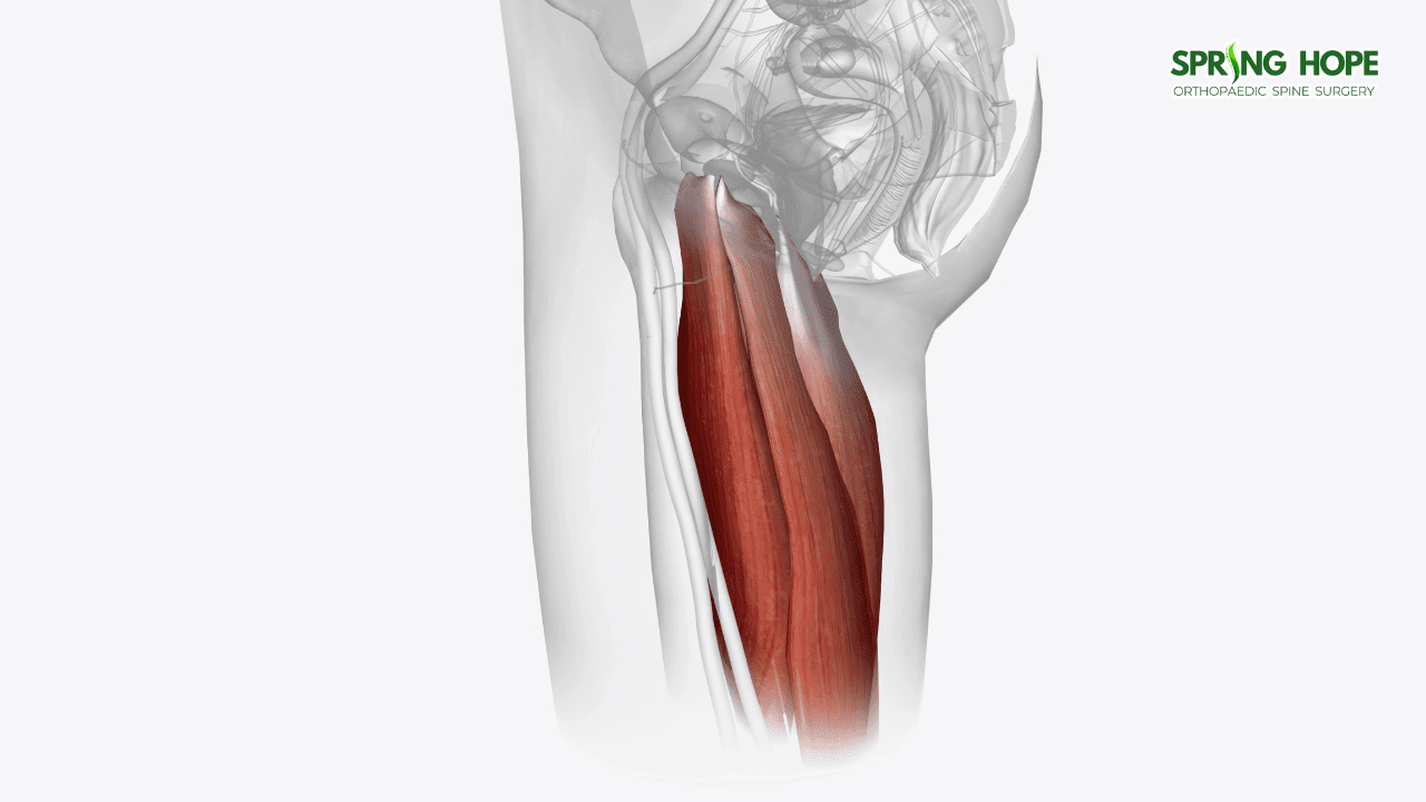 Tendinosis