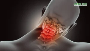 Cervical Spondylotic Myelopathy: Protecting the Spinal Superhighway