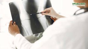 Understanding Total Knee Replacement Surgery: Procedure, Recovery, and Long-Term Outcomes