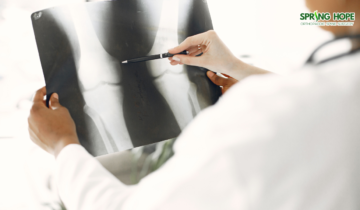 Understanding Total Knee Replacement Surgery: Procedure, Recovery, and Long-Term Outcomes